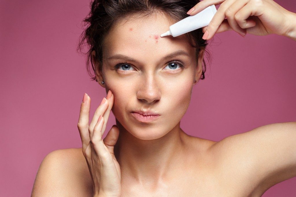 Woman applying something on her acne